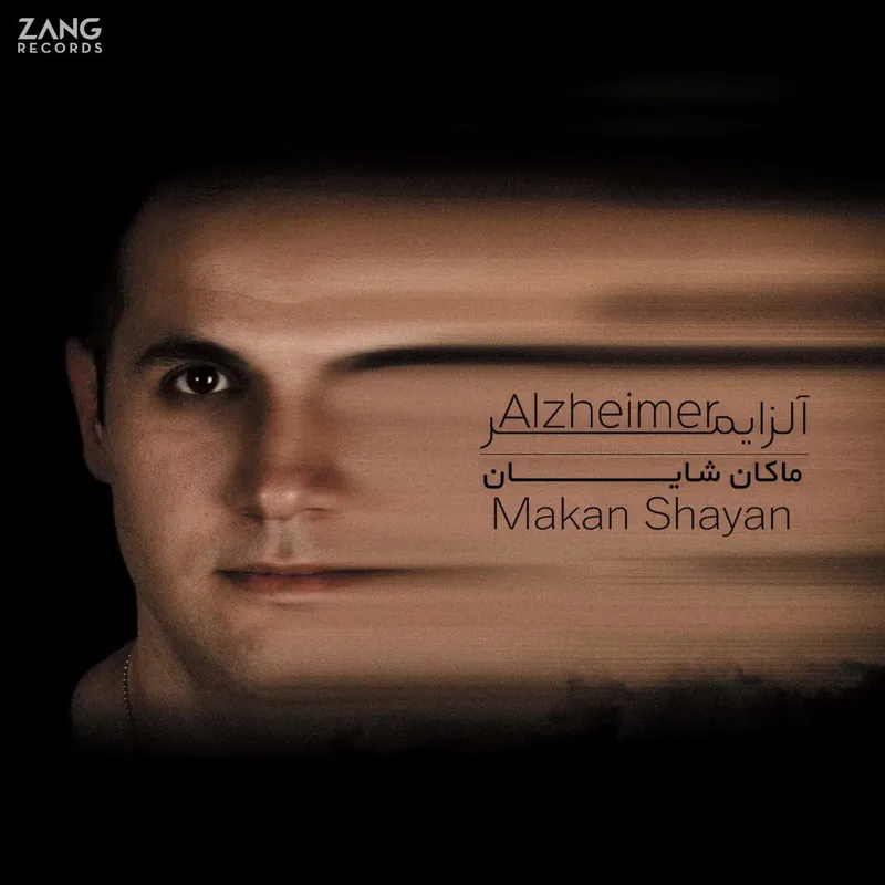 Alzhimer